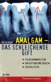 Amalgam - das schleichende Gift Amalgam - das schleichende Gift